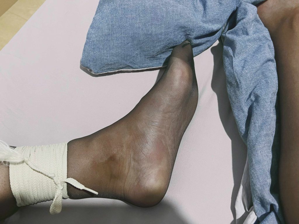左腿捆绑与脚丫颜色变化 / Left leg bondage with foot color changes