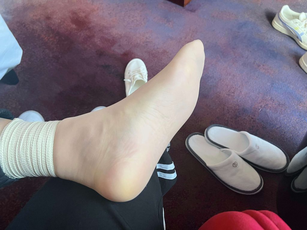 左腿紧缚后的脚趾颜色变化 / Toe color changes after tight left leg bondage