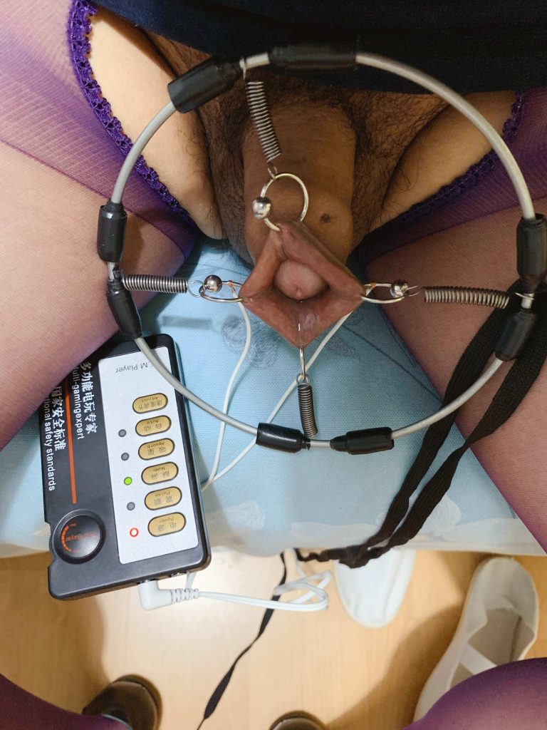 包皮重口味极限扩张最终状态 / Final extreme foreskin expansion condition