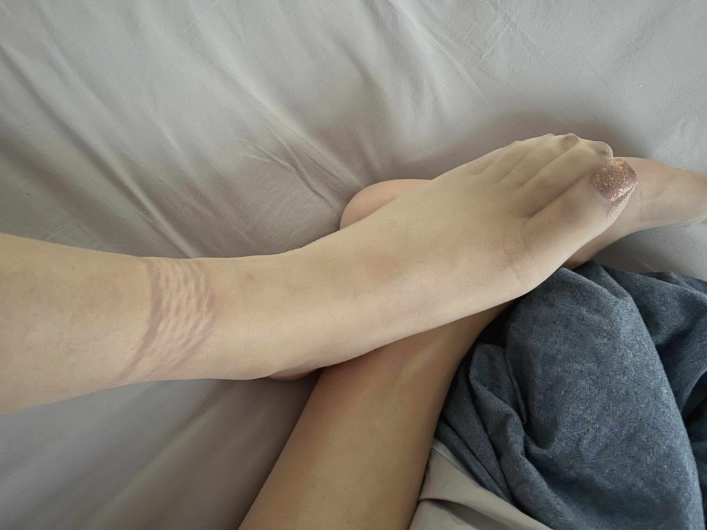 极限紧缚后的脚部状态记录 / Foot condition after extreme tight bondage