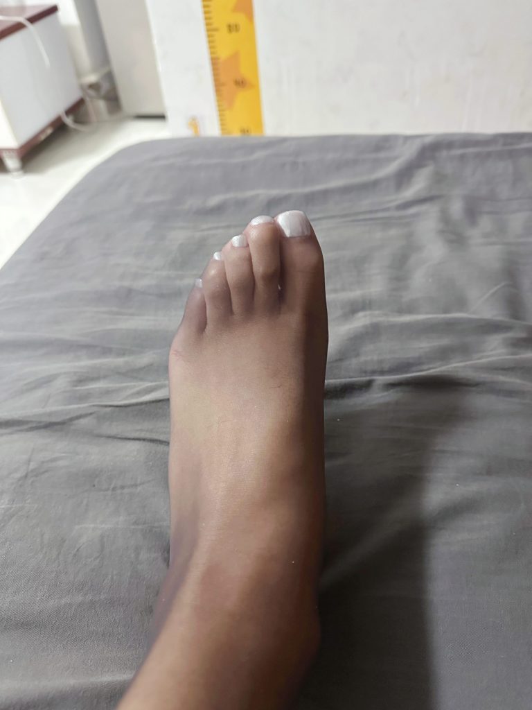 双腿折绑与黑丝足底展示 / Folded leg bondage with black stockings sole view
