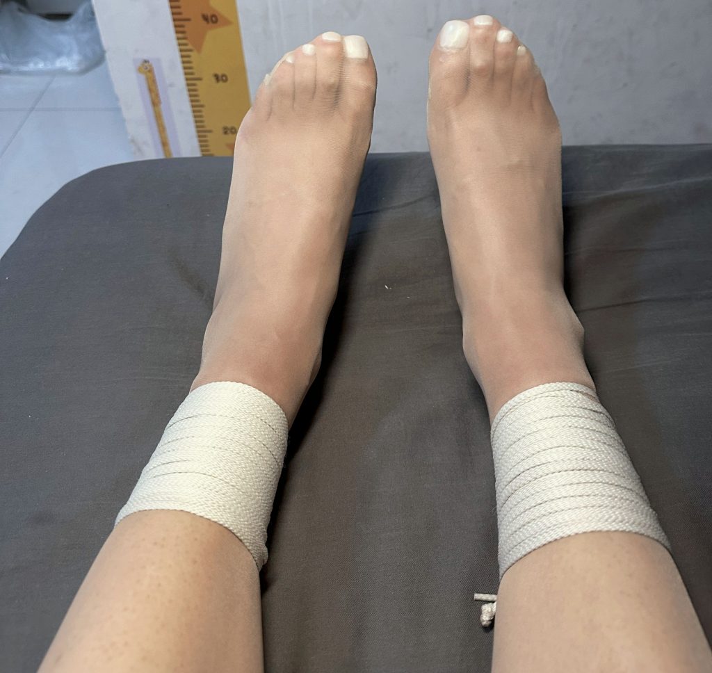 单腿与双腿捆绑对比 / Single and double leg bondage comparison