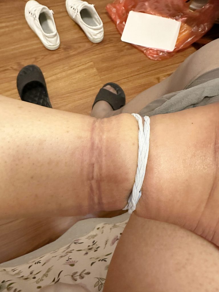 丝袜覆盖腿部束缚的细节 / Stockings over leg bondage detail