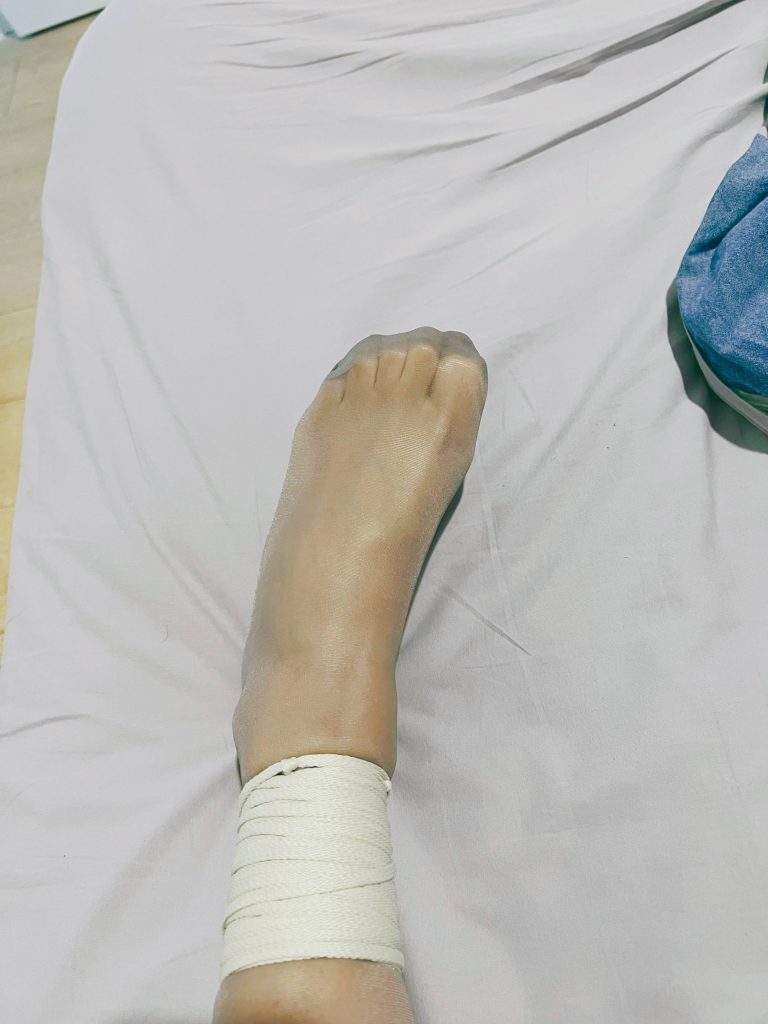 左腿极限紧缚与脚部变化 / Extreme left leg bondage and foot changes
