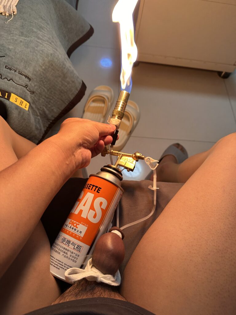 包皮低温冻伤与喷火后的身体状态 / Foreskin condition after extreme cold and flame exposure
