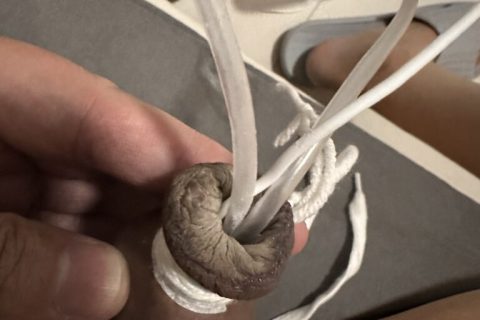 包皮束缚后的极限身体改造状态 / Restrained foreskin during an extreme body modification session