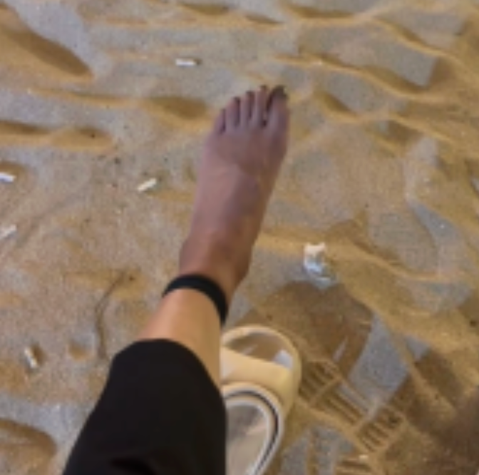 巴厘岛海滩捆绑体验｜左脚发麻发黑后的真实状态