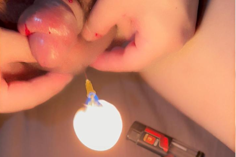 阴囊异常鼓起与穿刺喷火记录 / Inflated scrotum with piercing and flame incident